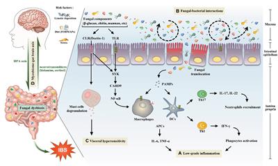 The Potential Role of Gut Mycobiome in Irritable Bowel Syndrome